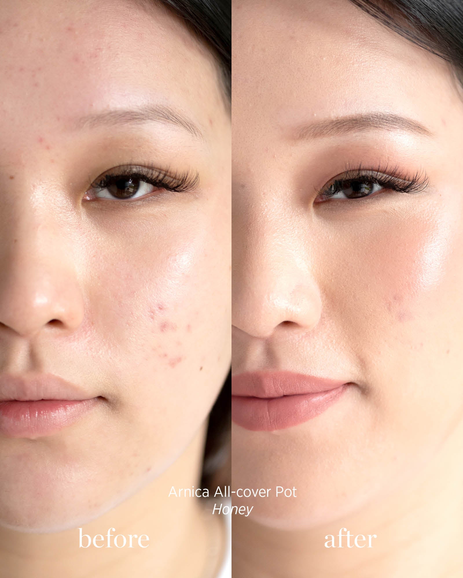 Before and after image of person who has applied Arnica All Cover Pot in the shade honey