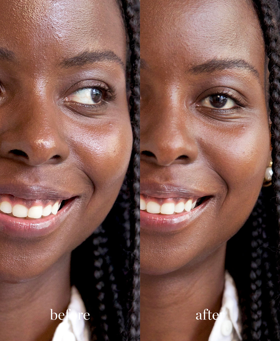 Coverage comparison of natural & gentle corn setting powder applied on sensitive skin giving a matte and balanced complexion