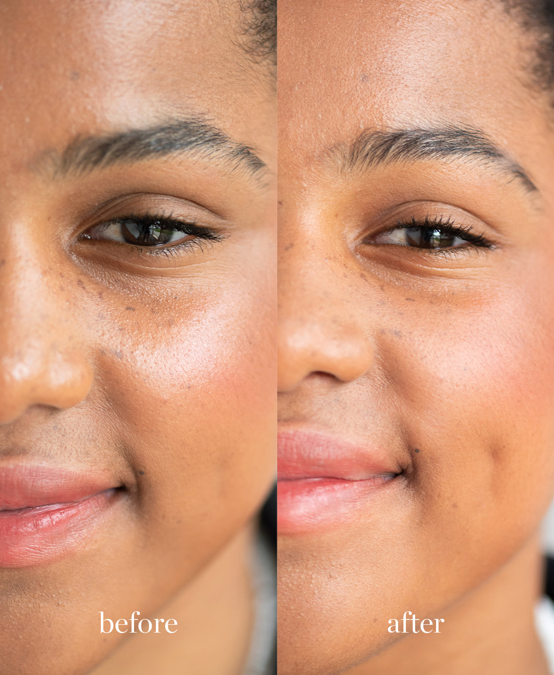 Coverage comparison of natural & gentle corn setting powder applied on sensitive skin absorbing oil for a shine-free look