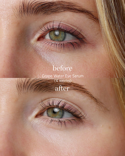 comparison after application over 4 weeks of eco-friendly eye roller and grape water serum