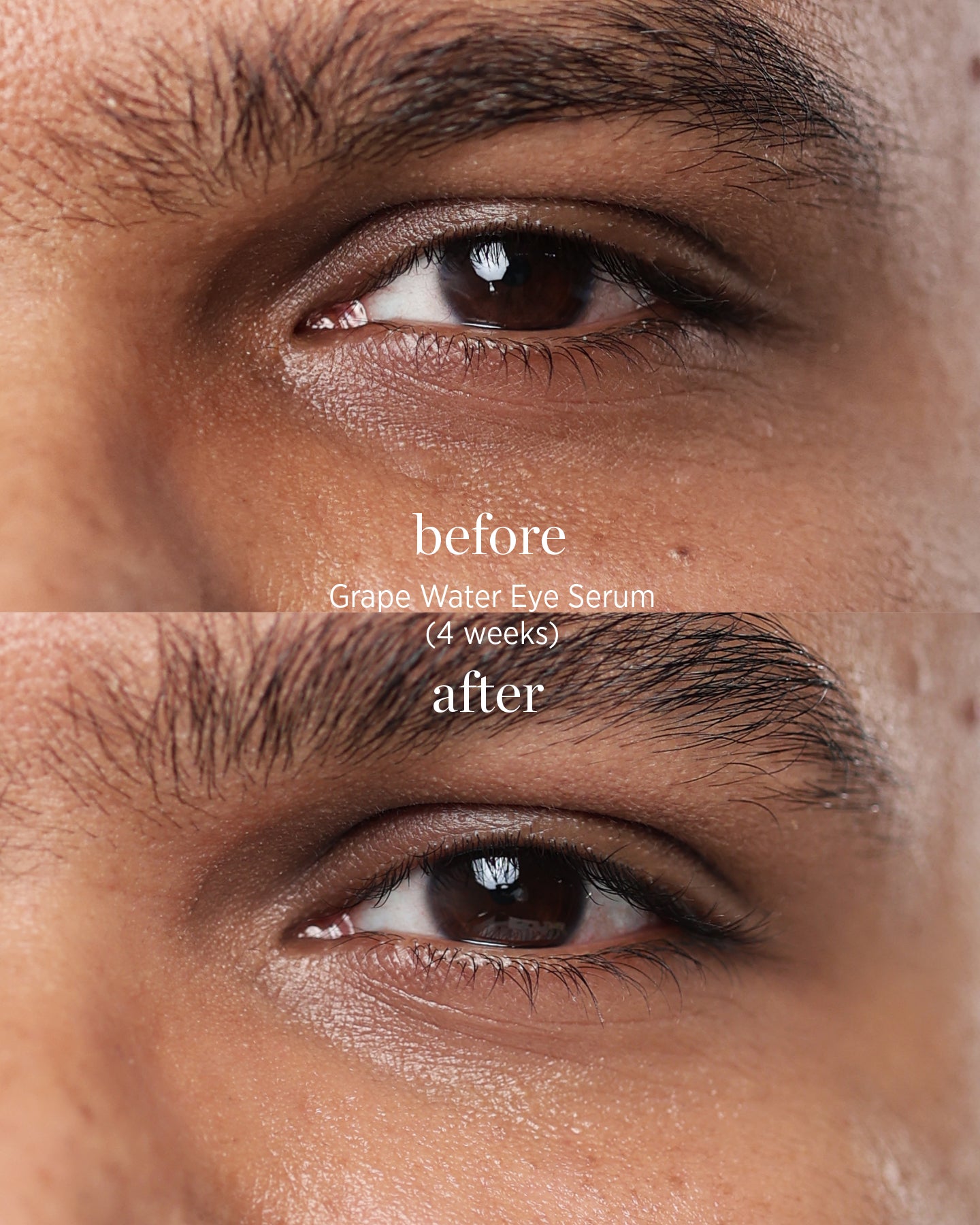 comparison after application over 4 weeks of natural grape water eye serum