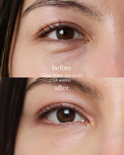 comparison after application over 4 weeks of organic grape water eye serum
