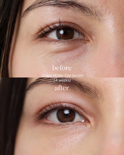 grape water eye serum