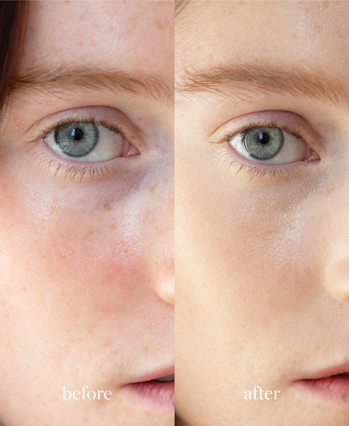 Coverage comparison of nourishing lychee creme corrector applied on the skin giving a clear and even complexion