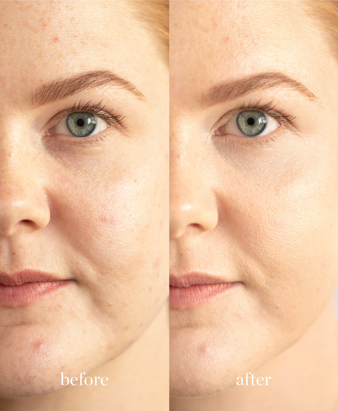 Coverage comparison of nourishing and natural lychee creme corrector applied on the skin for a bright, refreshed skin