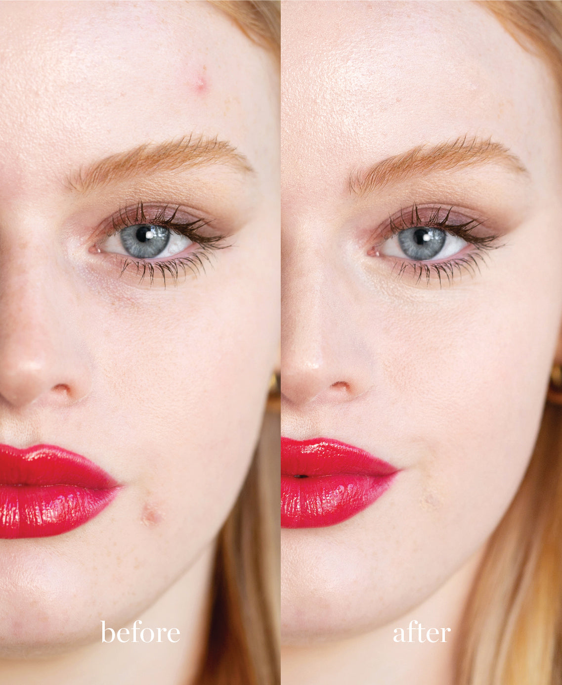 Coverage comparison of nourishing lychee creme corrector applied on the skin for a bright, refreshed skin