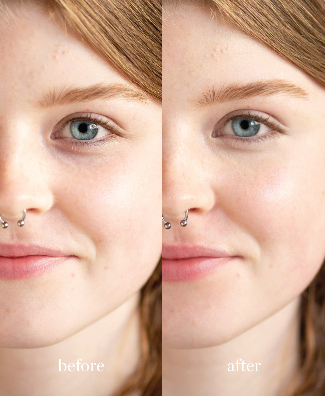 Coverage comparison of hydrating lychee creme corrector applied on the skin giving a smooth and bright complexion