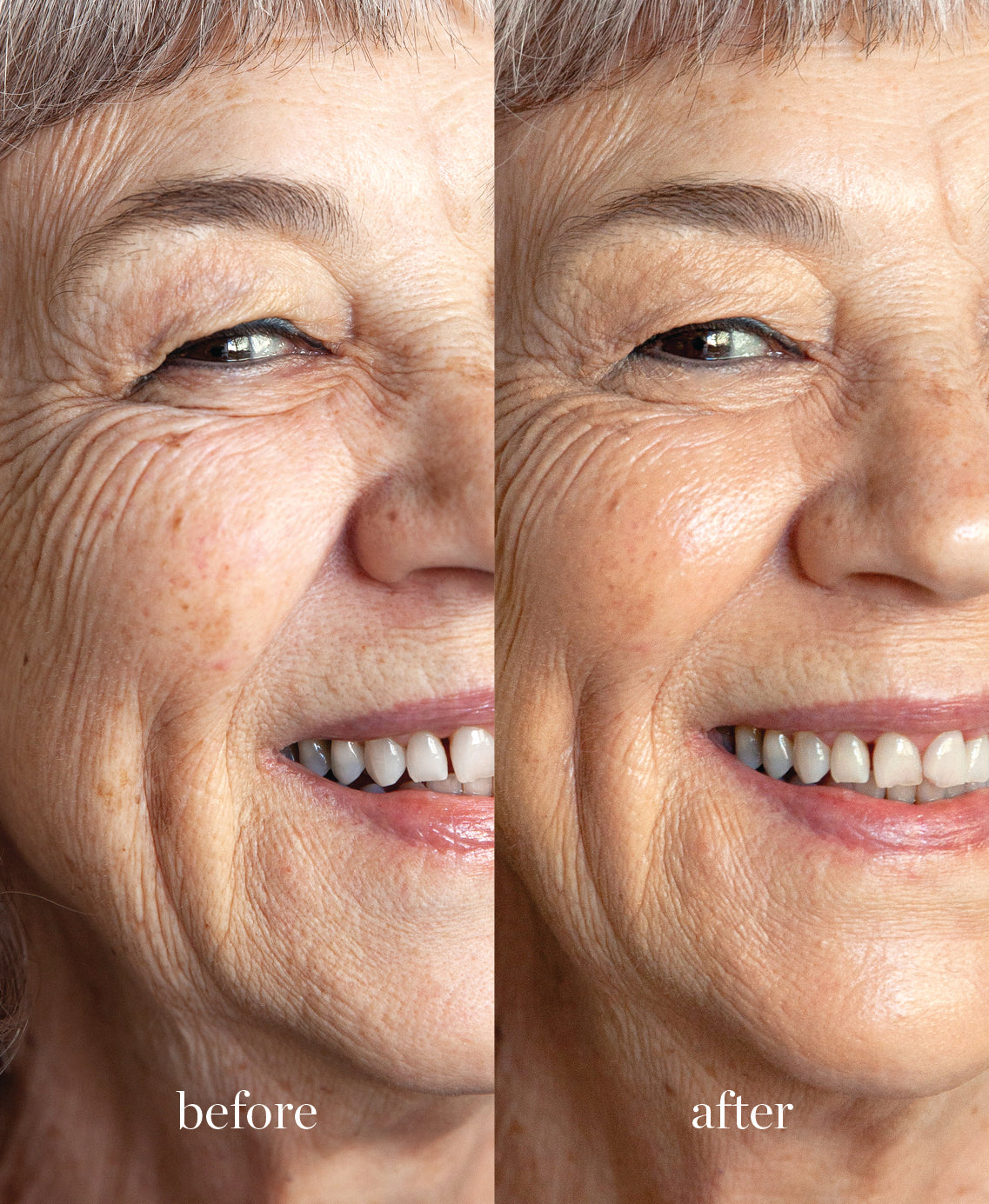 Coverage comparison of nourishing lychee creme corrector applied on the skin having a rejuvenating effect for a youthful complexion