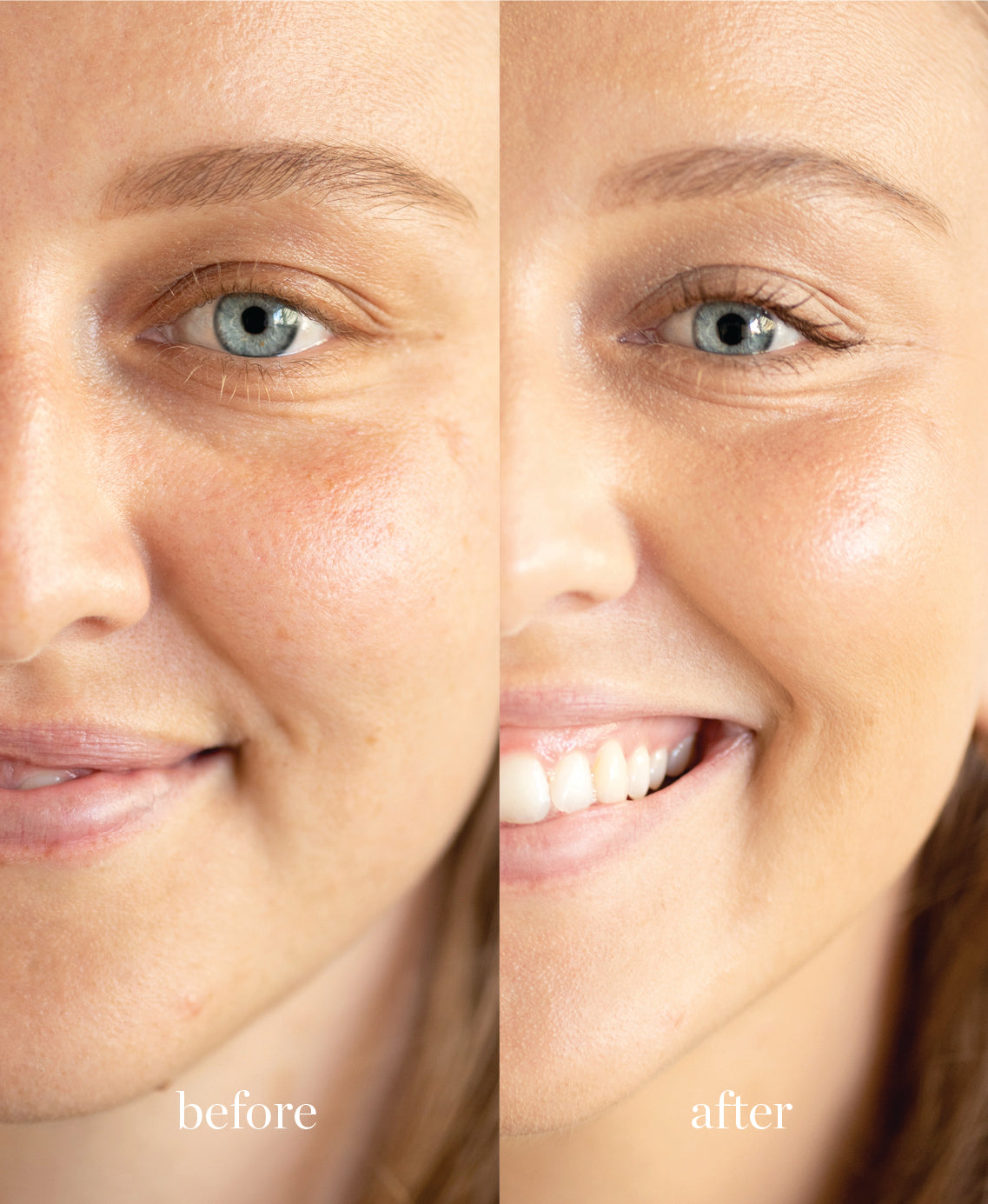 Coverage comparison of nourishing lychee creme corrector applied on the skin giving a brightened and even complexion