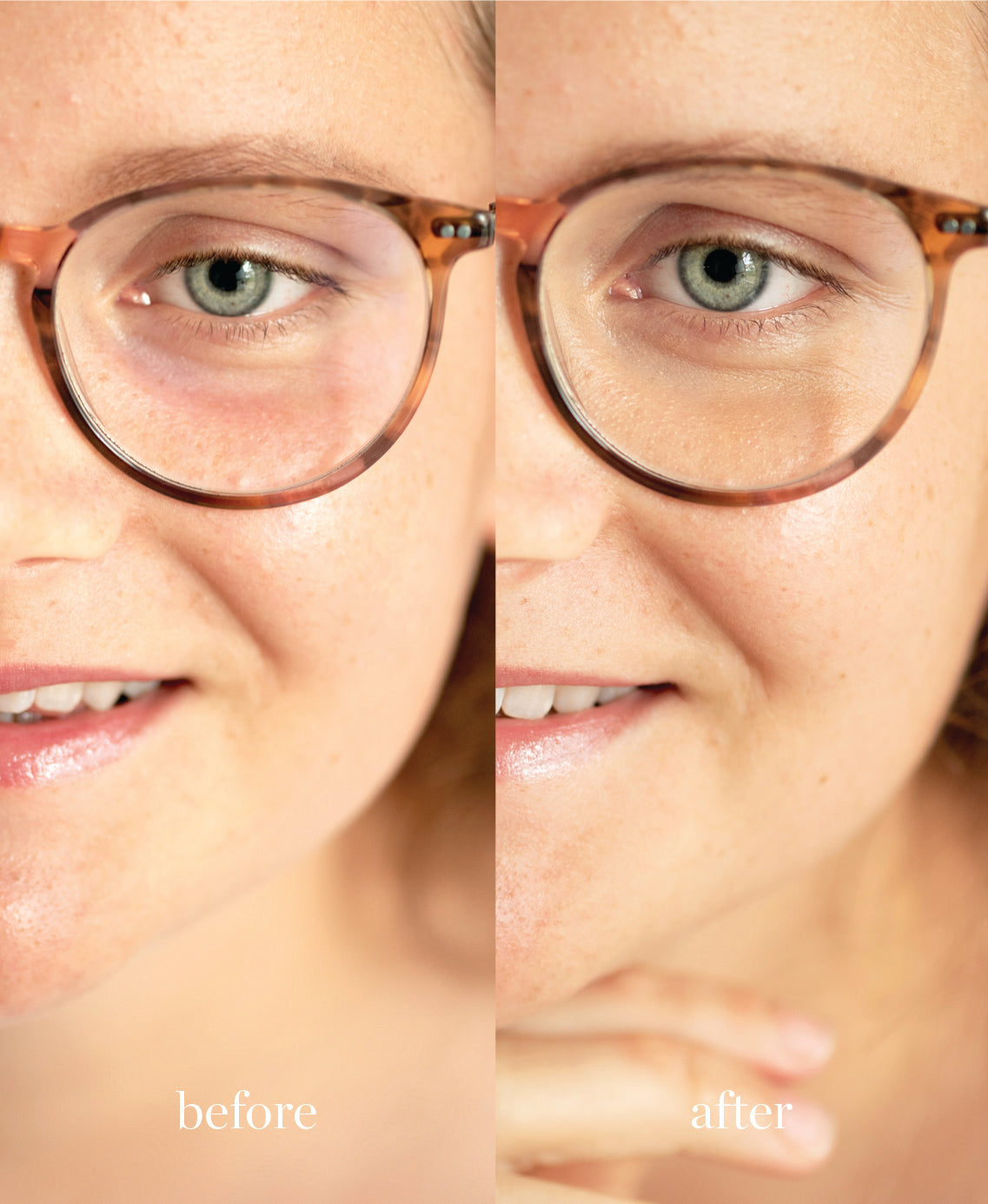 Coverage comparison of nourishing lychee creme corrector applied on the skin giving a refreshed look by providing coverage