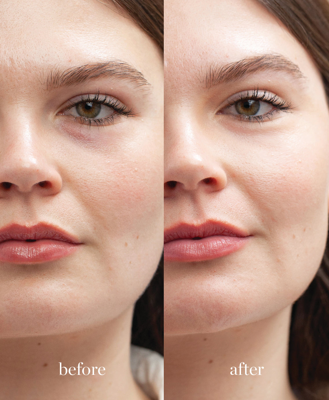 Coverage comparison of nourishing lychee creme corrector applied on the skin adding light to the skin for a bright look