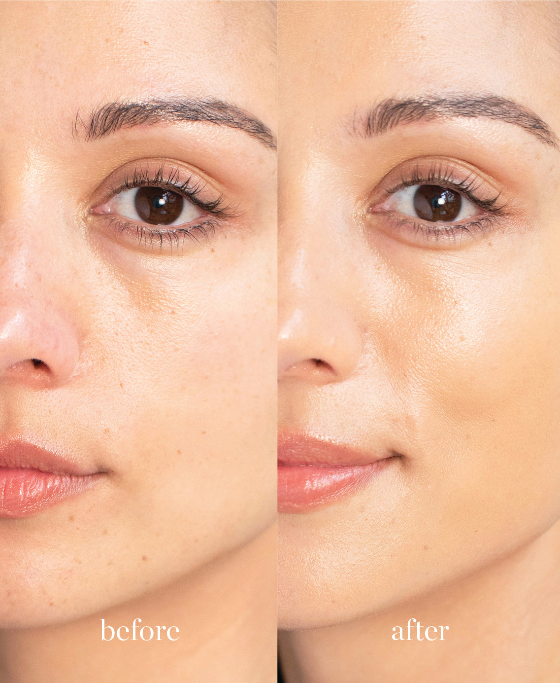 Coverage comparison of nourishing lychee creme corrector applied on the skin giving a brighter and even complexion