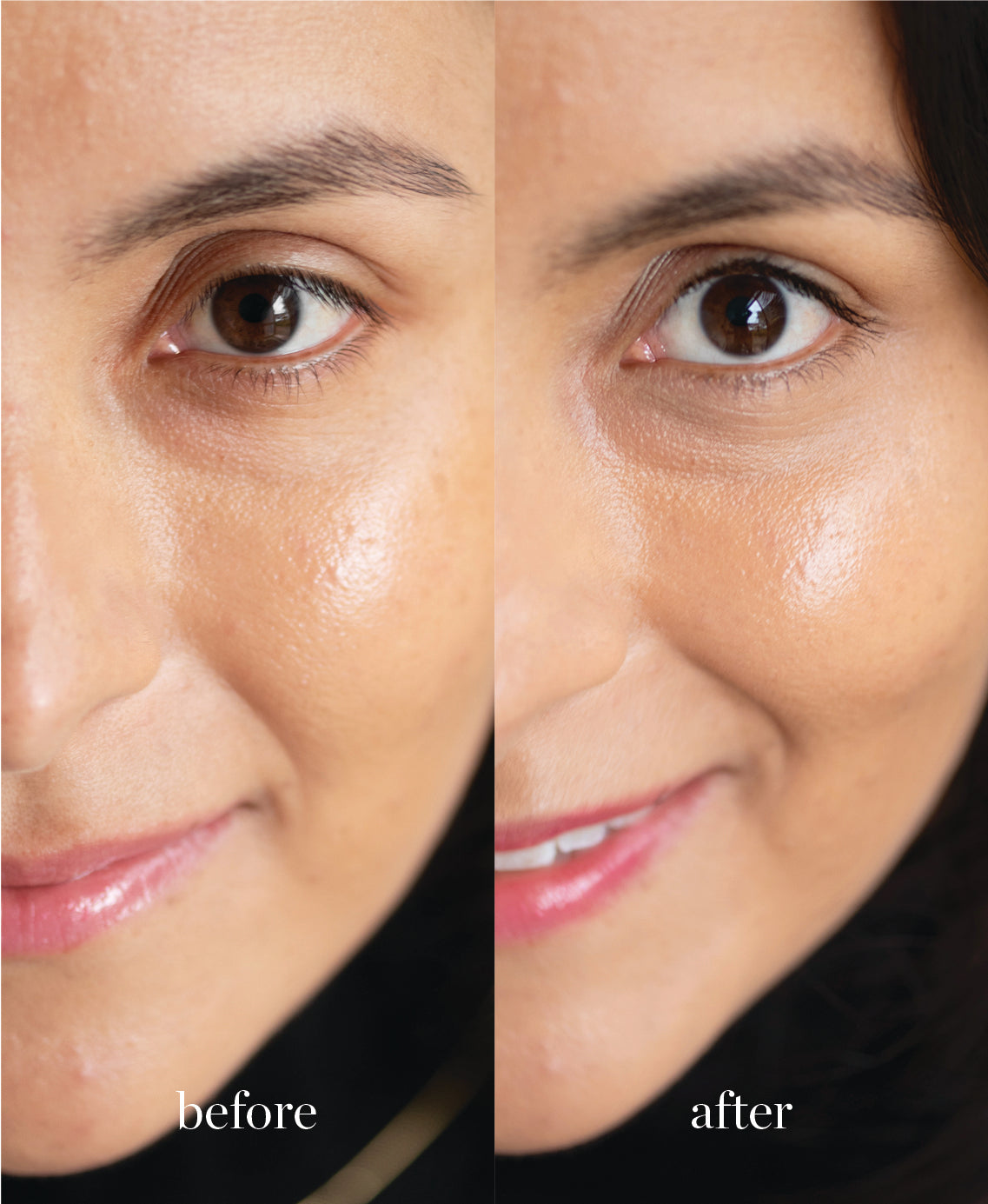 Coverage comparison of nourishing lychee creme corrector applied on the skin giving a refreshed and even complexion