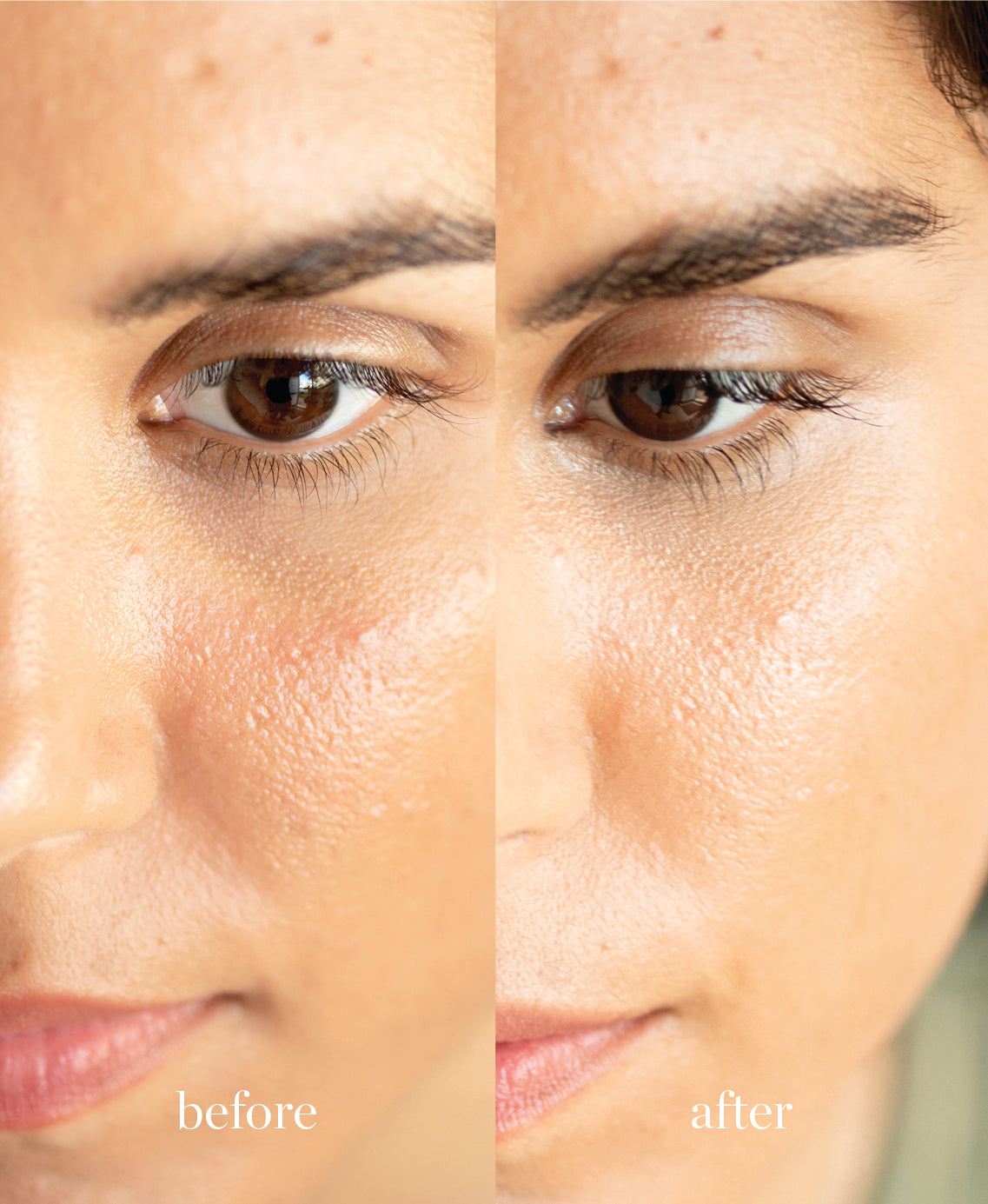 Coverage comparison of nourishing lychee creme corrector applied on the skin giving a brighter and smoother complexion