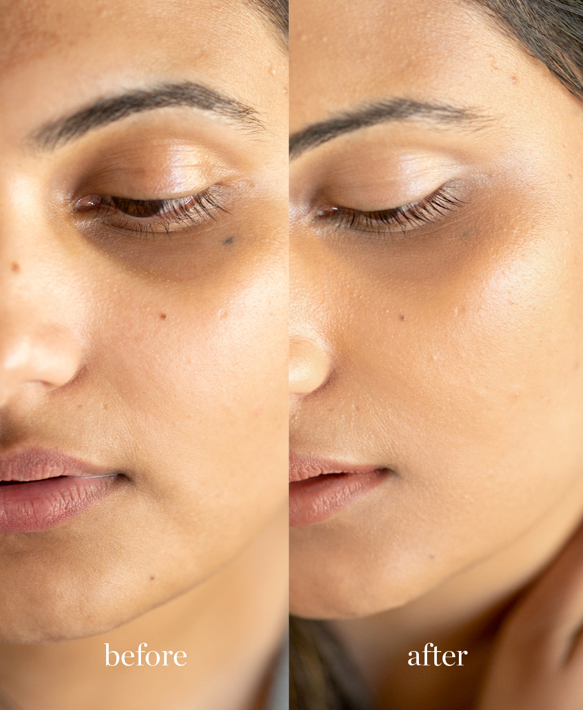 Coverage comparison of all-natural lychee creme corrector applied on the skin giving a clear and even complexion