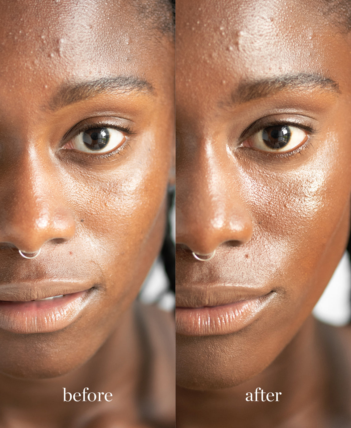 Coverage comparison of moisturising lychee creme corrector applied on the skin giving a clear and bright complexion