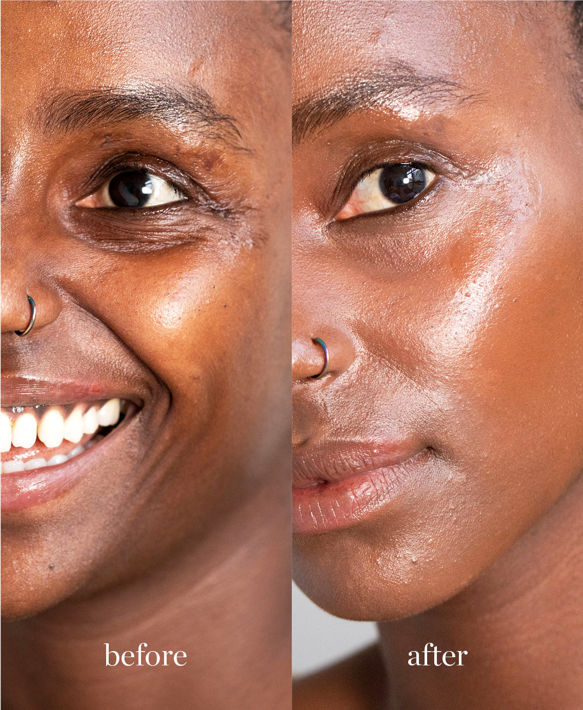 Coverage comparison of organic nourishing lychee creme corrector applied on the skin giving a bright and even complexion