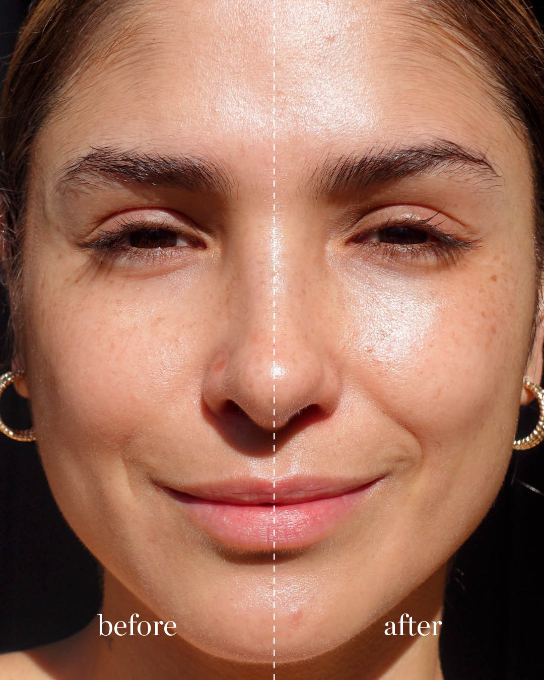 comparison after application of Ere Perez&