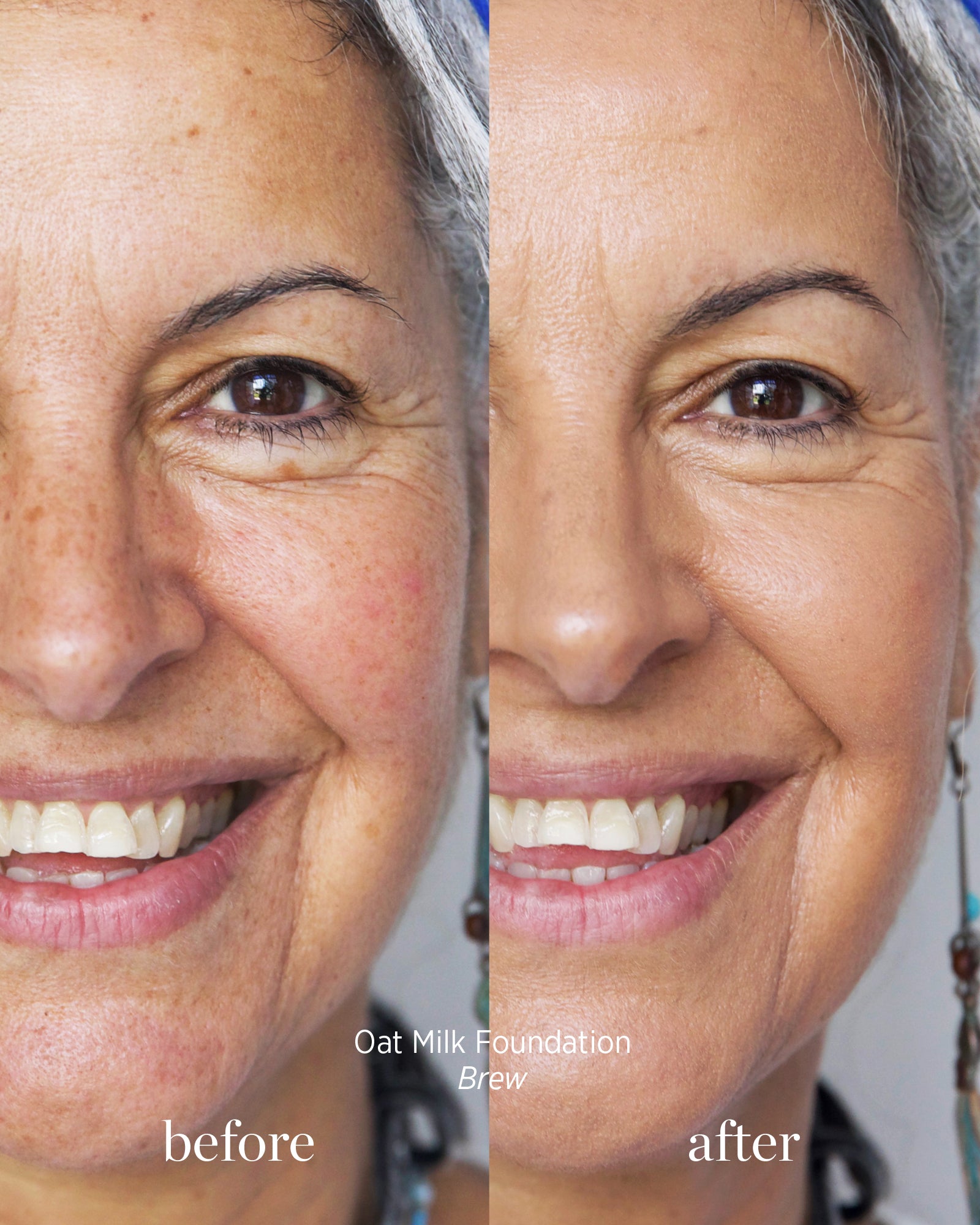 Before and after comparison of a woman&