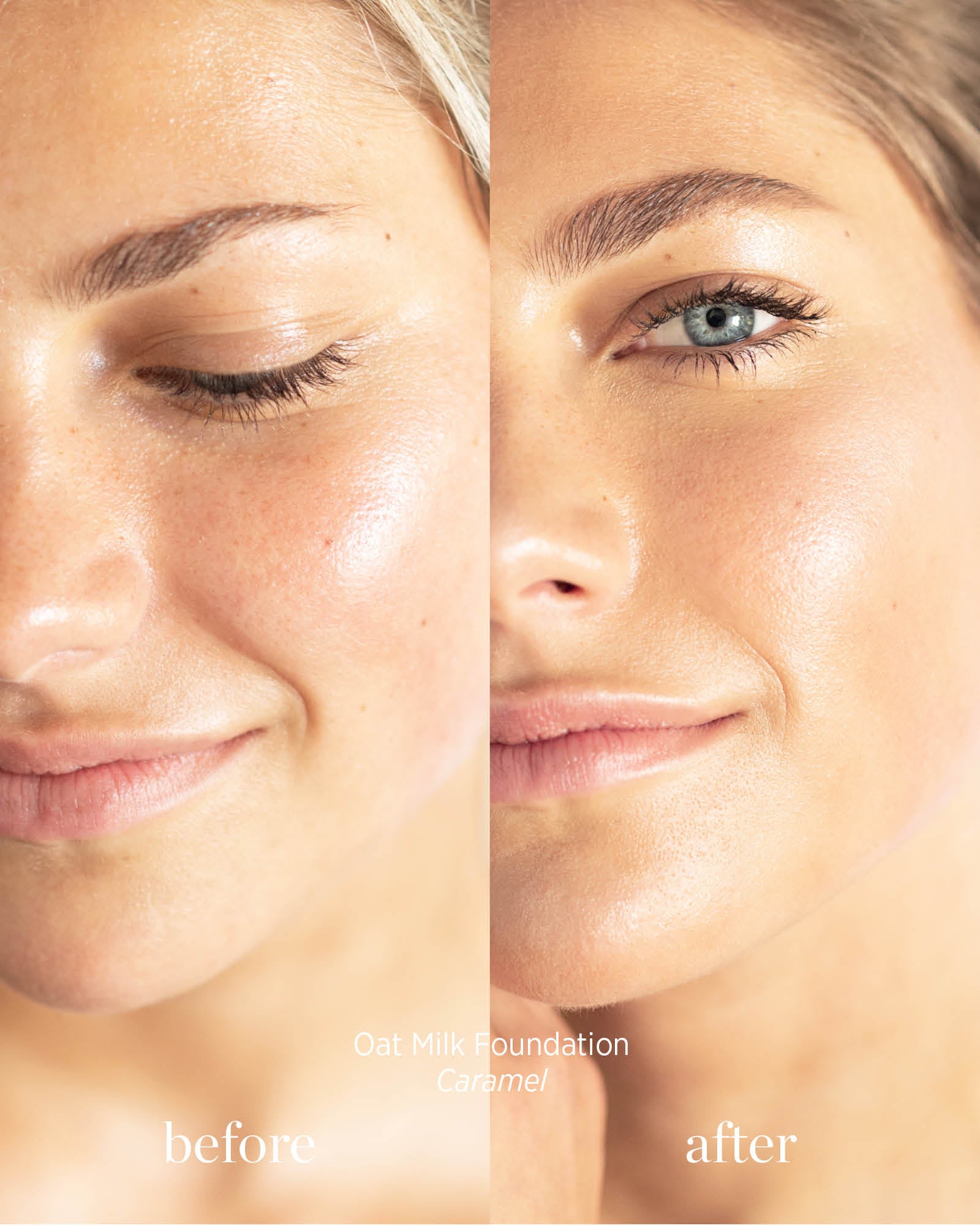 Before and after comparison of a woman&