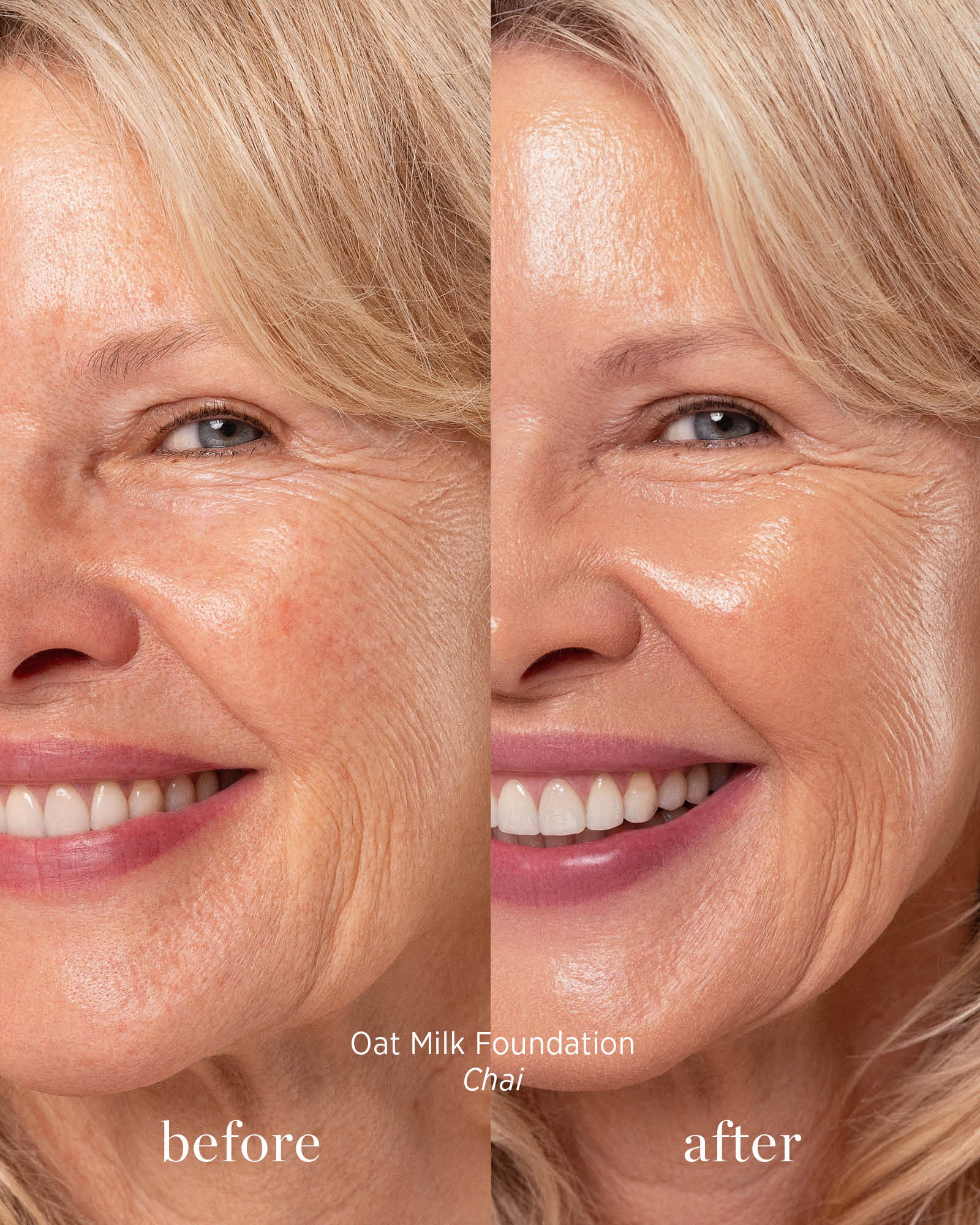 Before and after comparison of a woman&