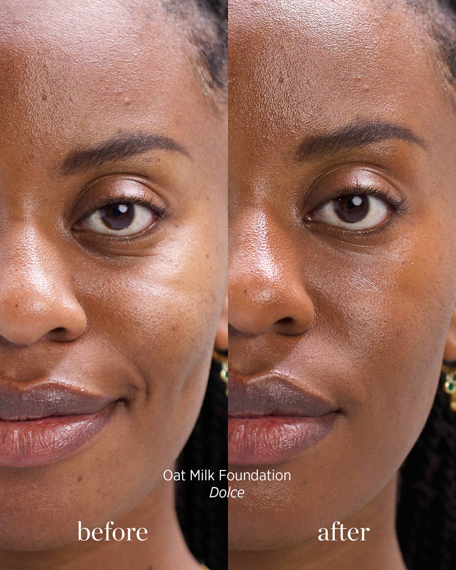 Before and after comparison of a woman&