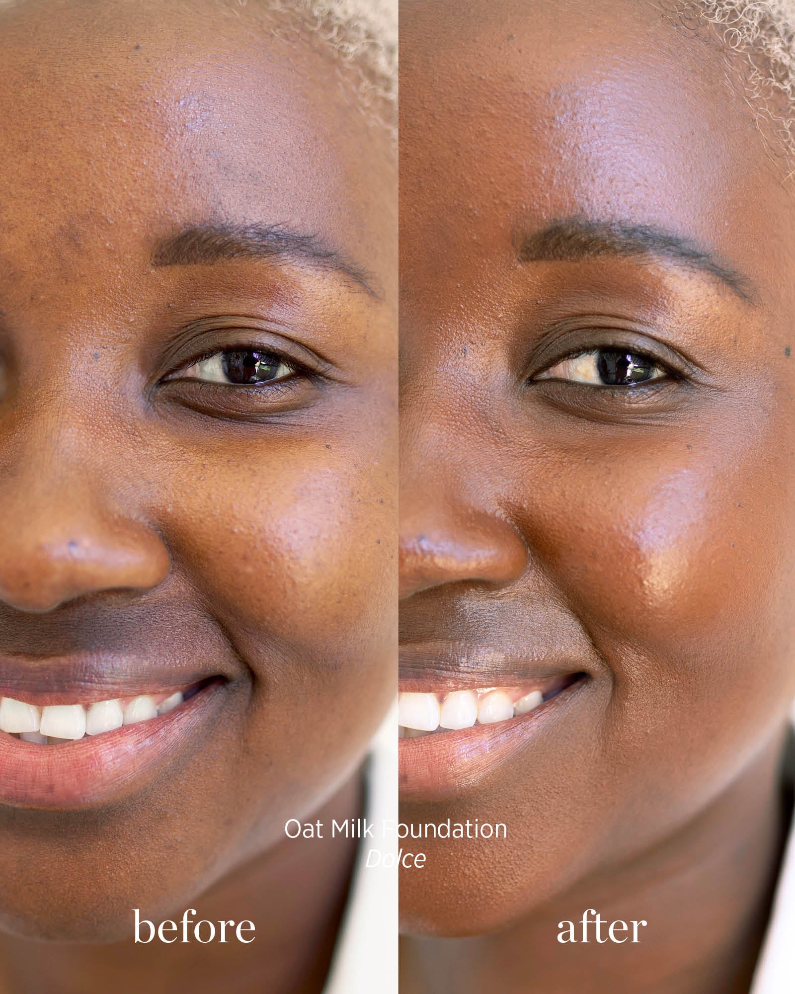 Before and after comparison of a woman&