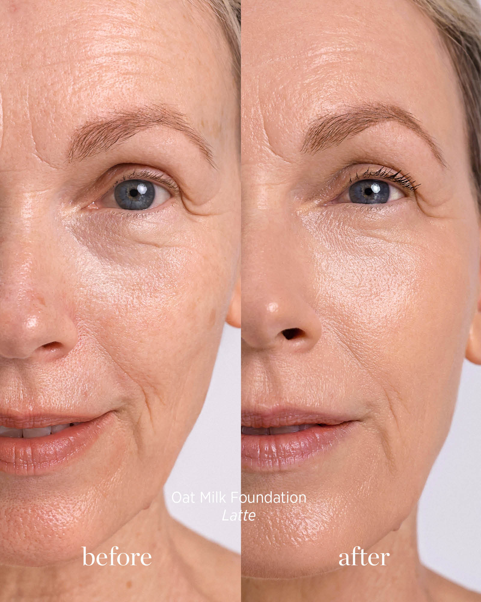 Before and after comparison of a woman&