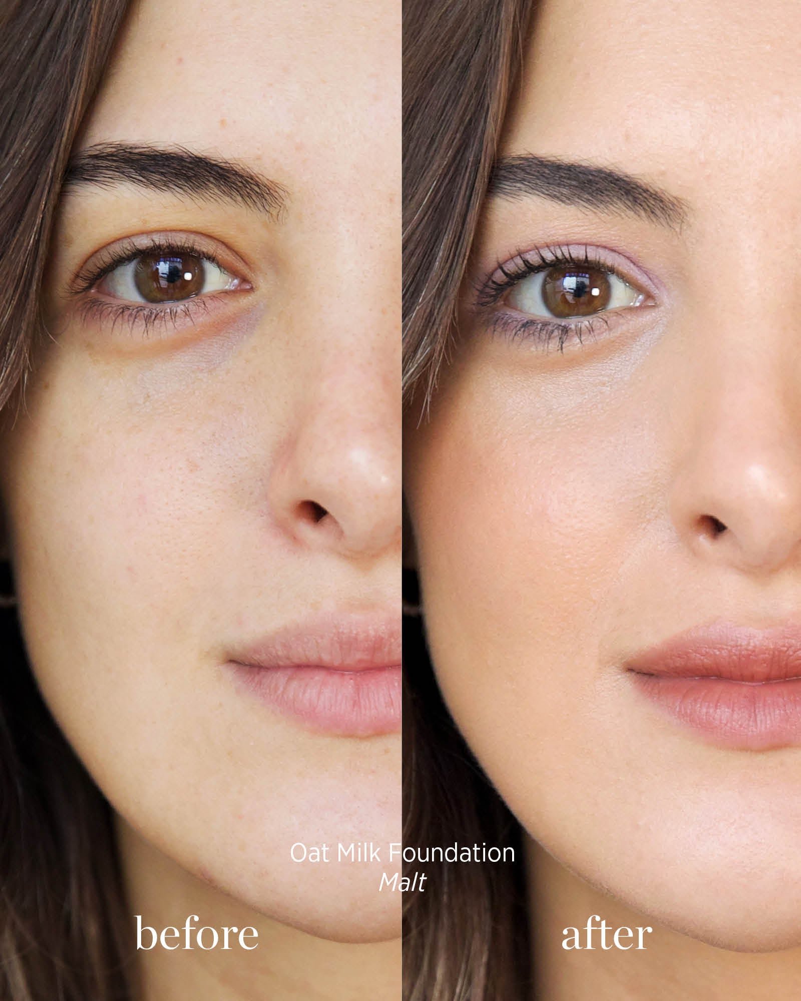 Before and after comparison of a woman&