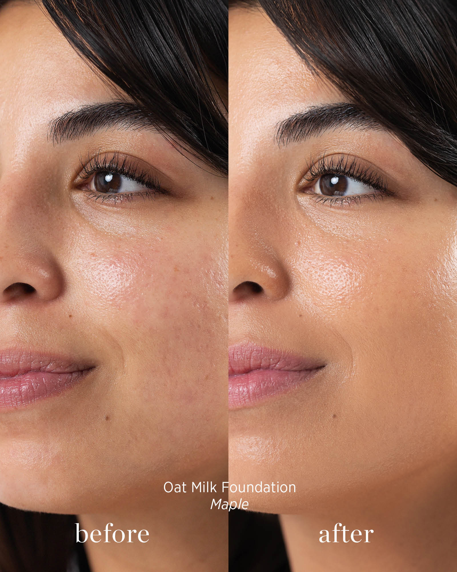 Before and after comparison of a woman&