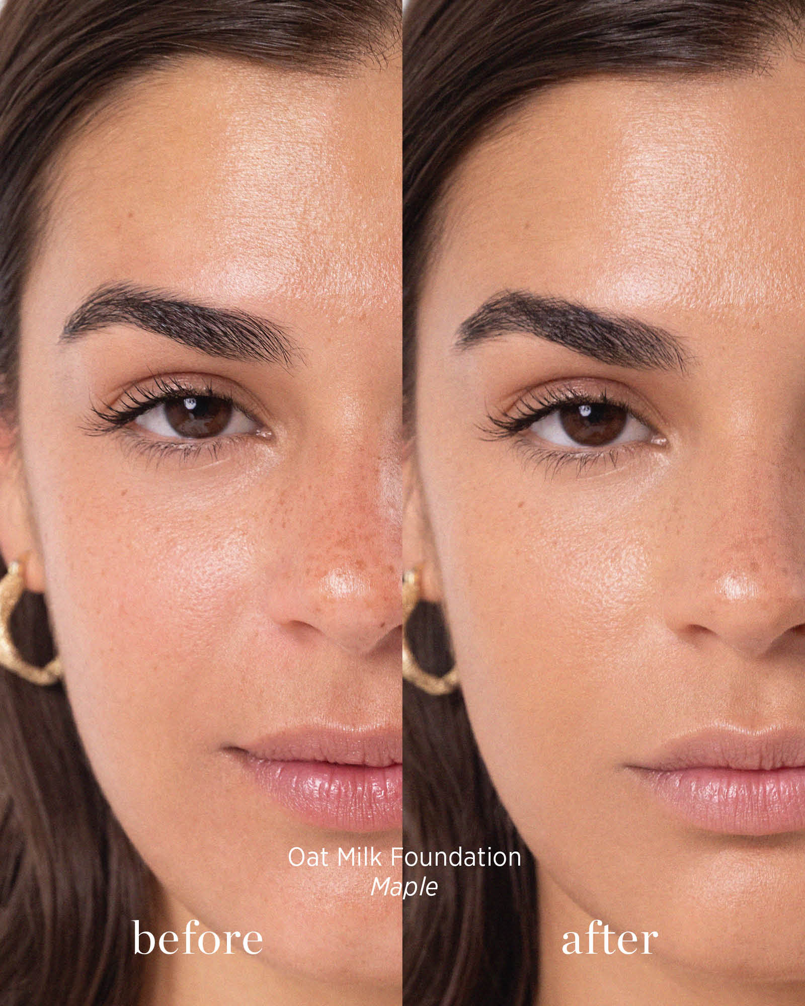 Before and after comparison of a woman&