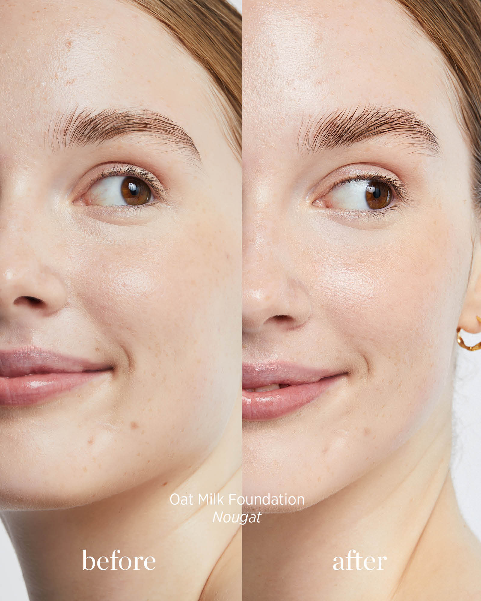 Before and after comparison of a woman&