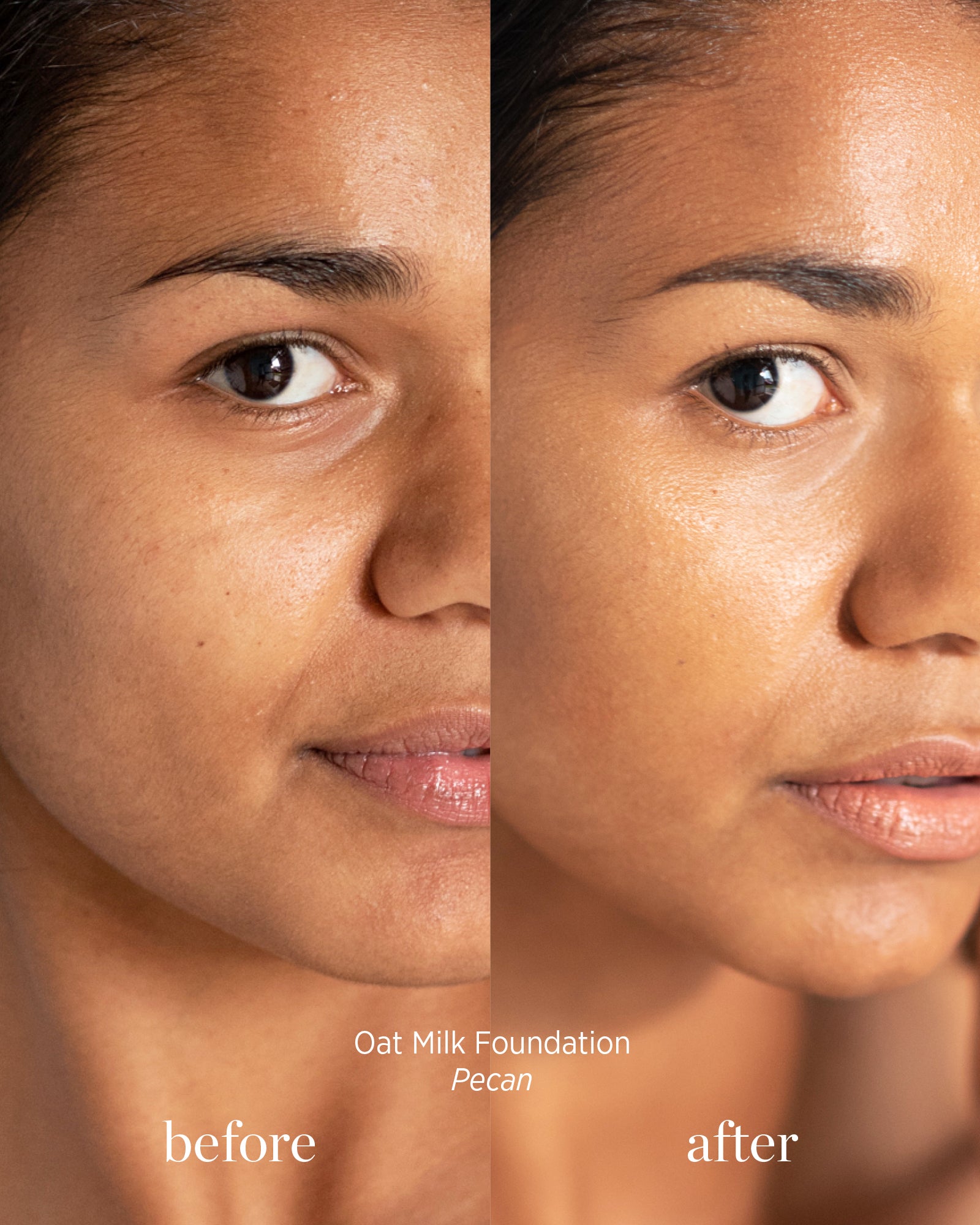 Before and after comparison of a woman&