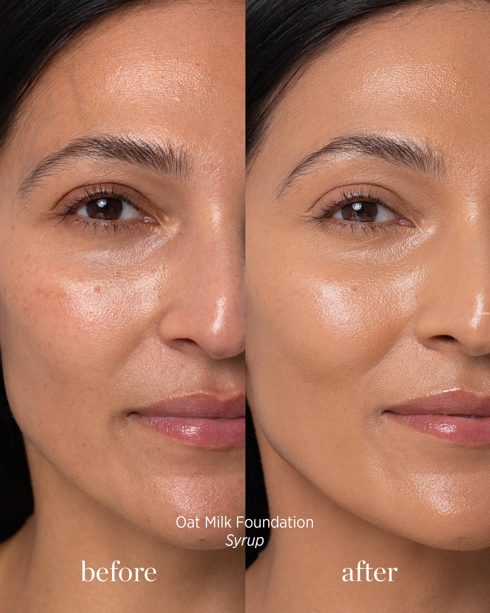 Before and after comparison of a woman&