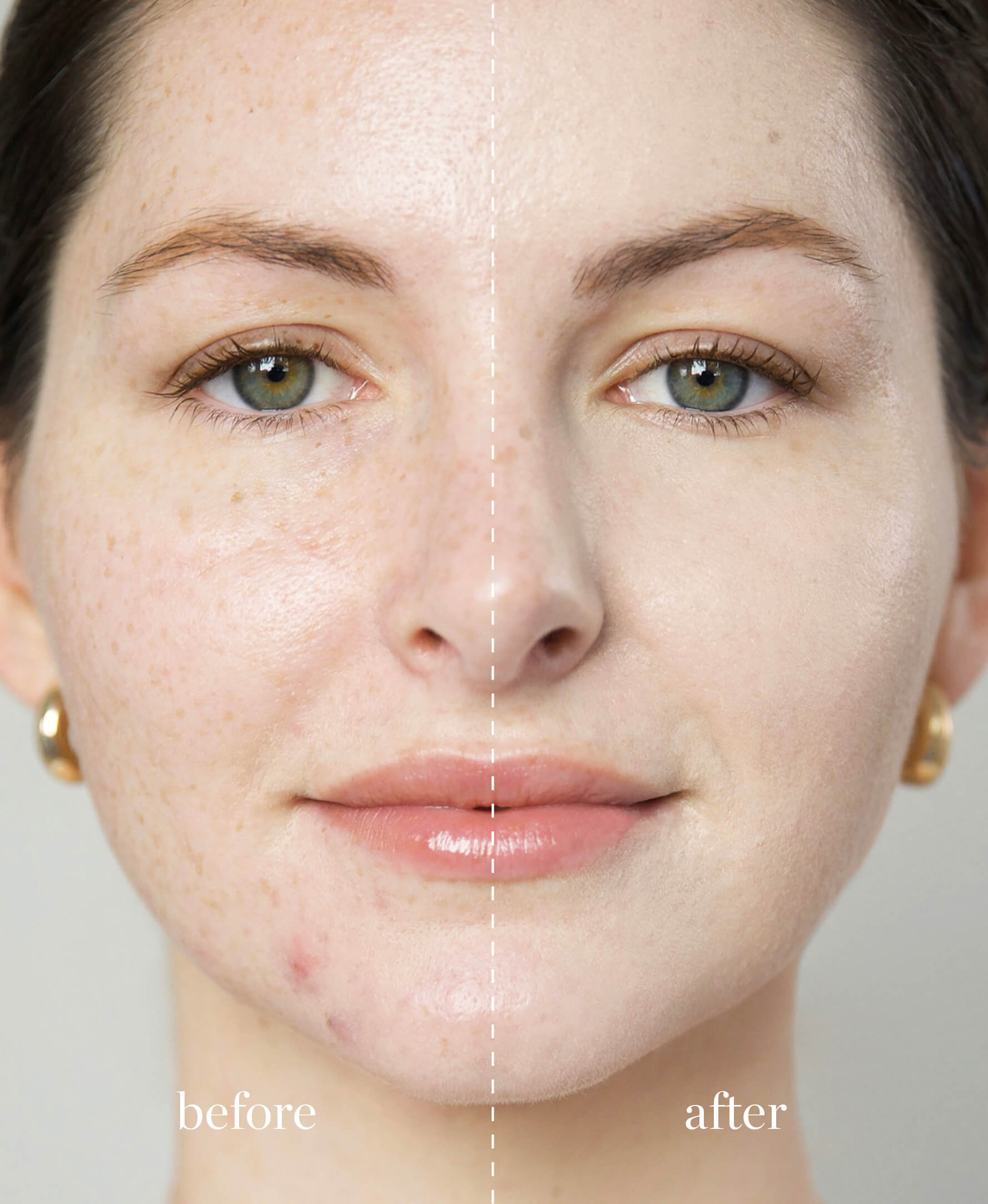 Coverage comparison of organic arnica all-cover foundation when applied to skin