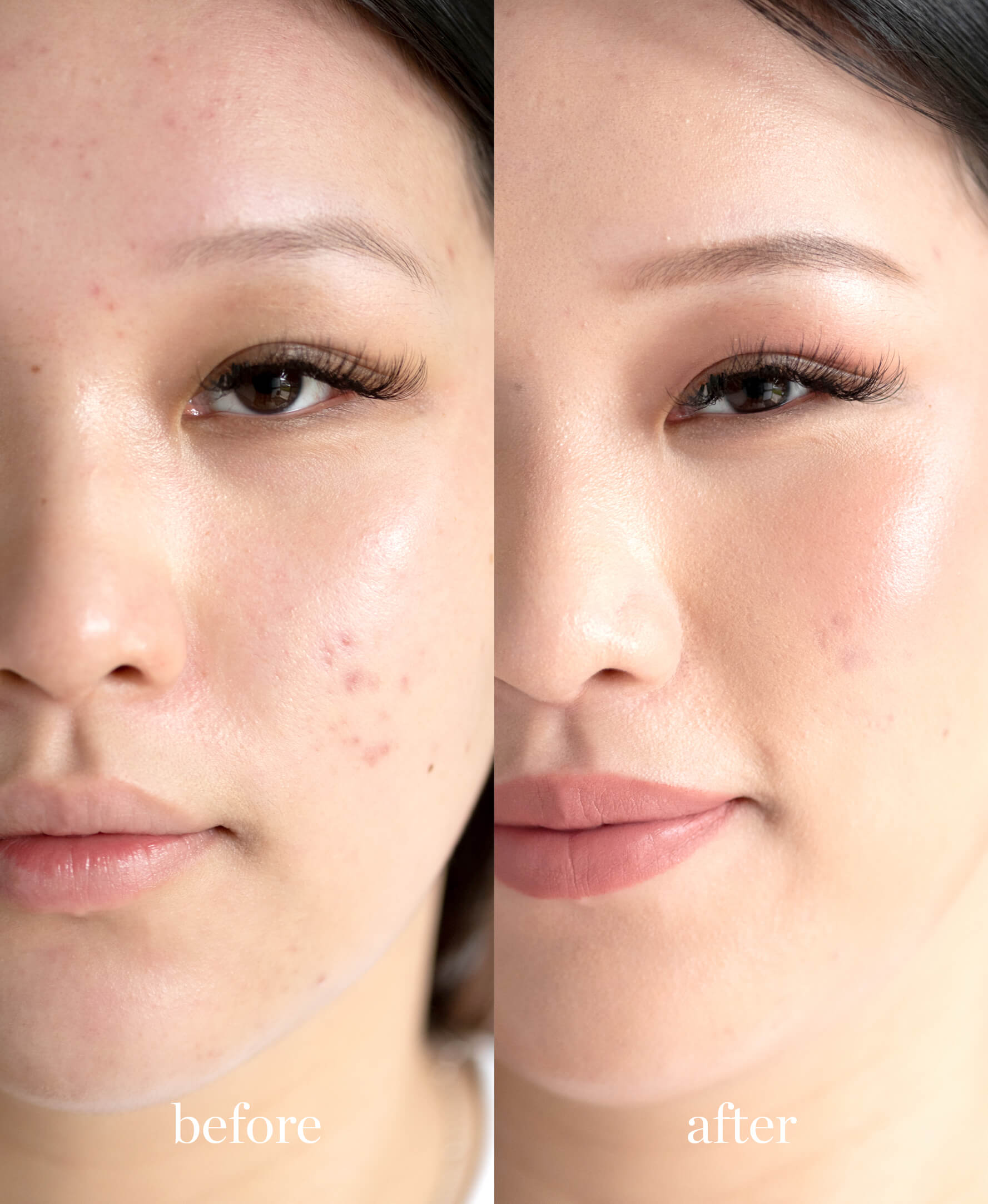 Coverage comparison of organic arnica all-cover concealer giving an even and radiant skin