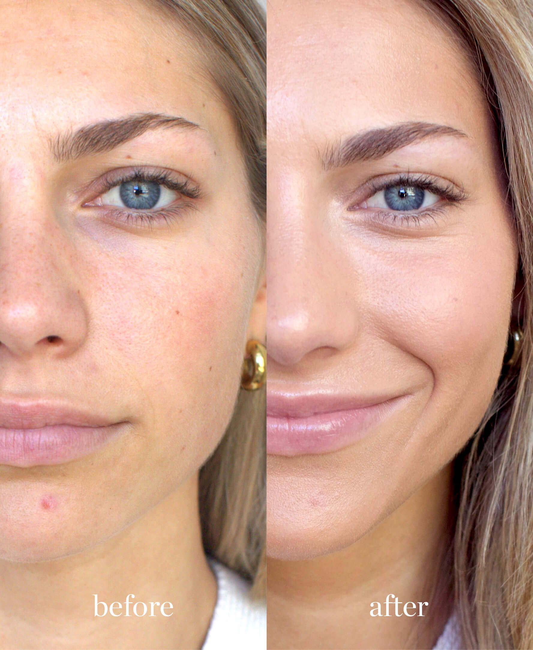 Coverage comparison of all-natural arnica concealer applied on skin