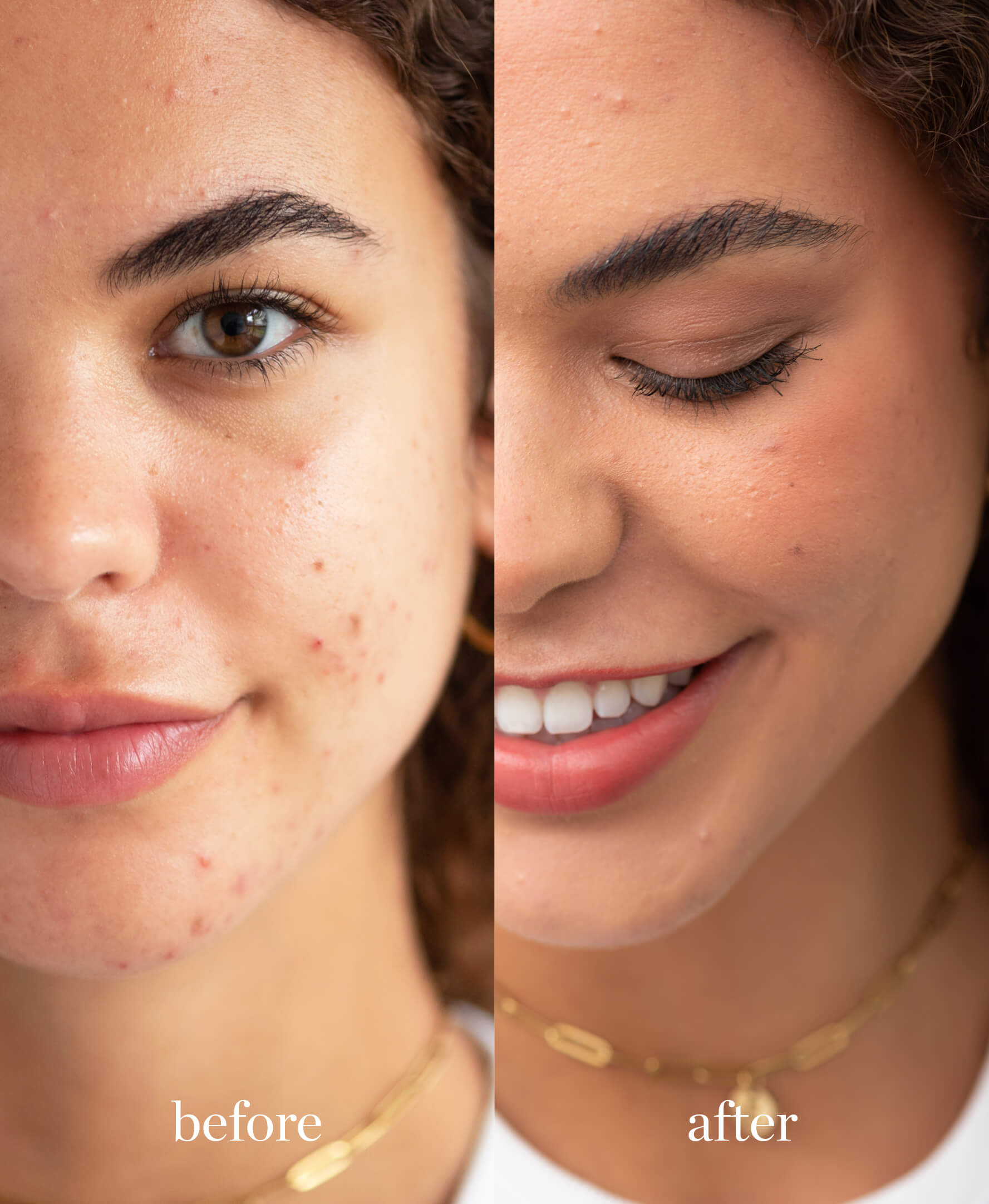 Coverage comparison of organic and gentle arnica concealer applied on skin