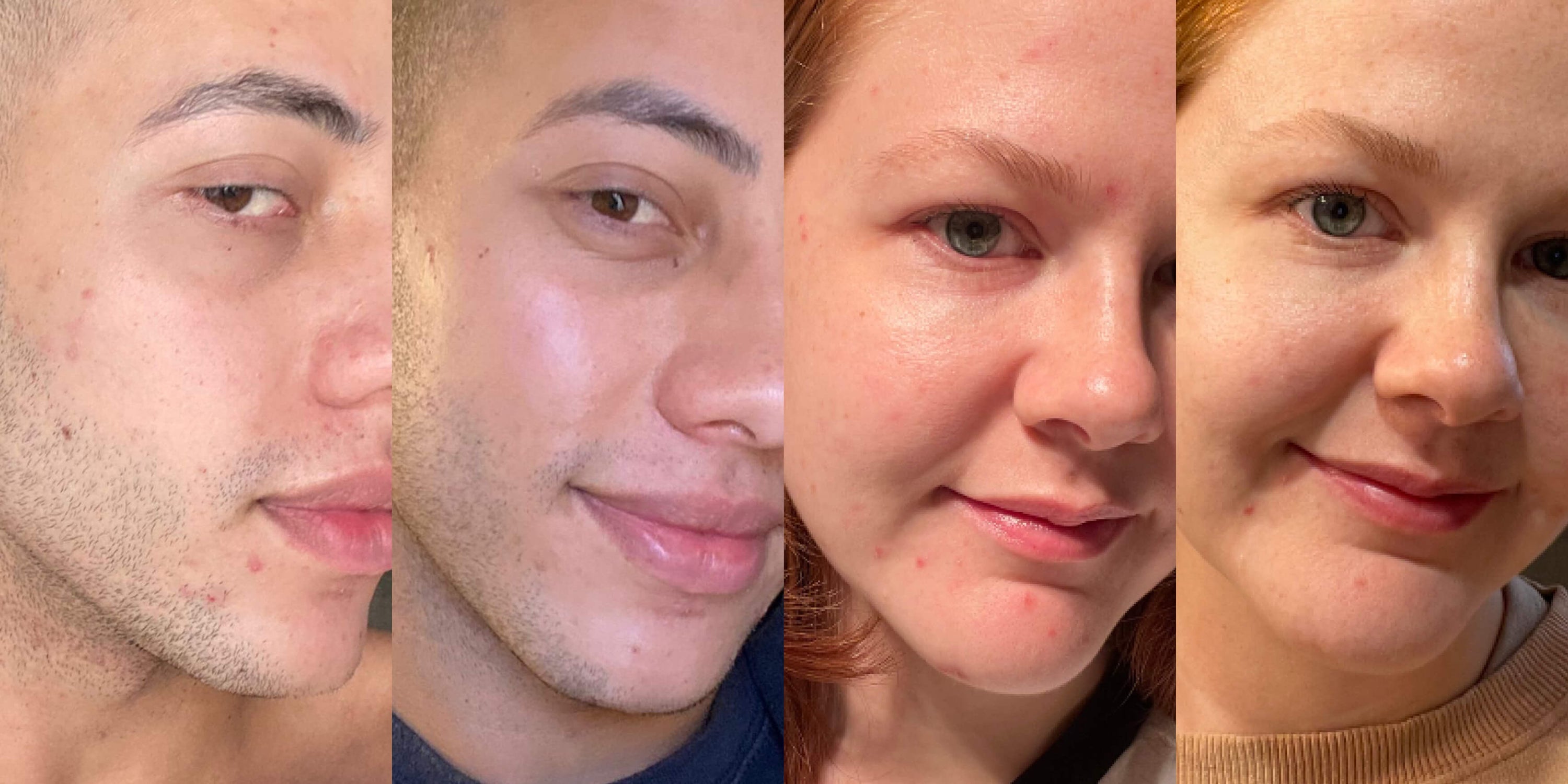 real skin, real results