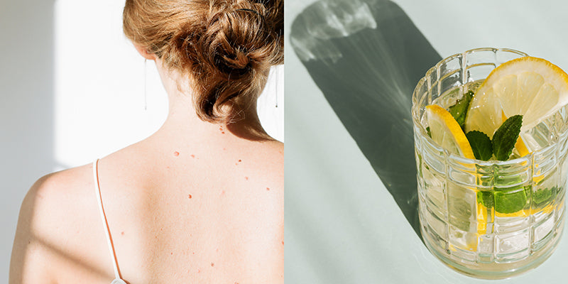 how to nurture your skin after the holidays