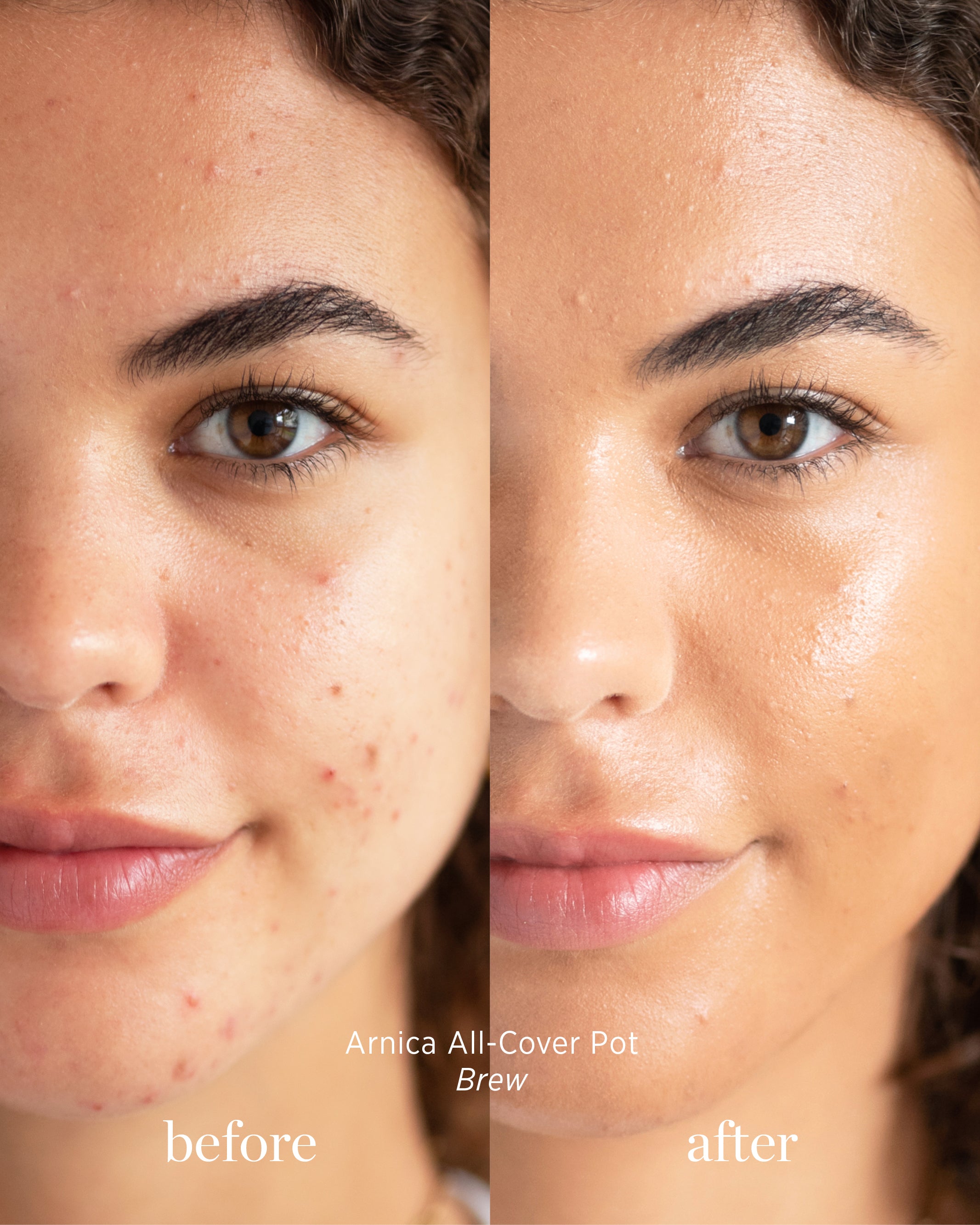 Before and after image of person who has applied Arnica All Cover Pot in the shade brew 