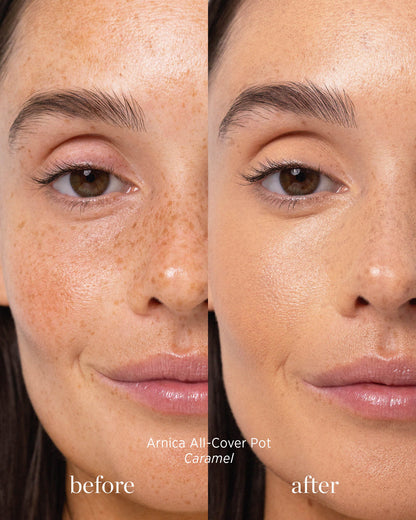 Before and after image of person who has applied Arnica All Cover Pot in the shade caramel 