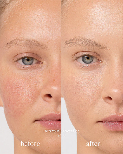 Before and after image of person who has applied Arnica All Cover Pot in the shade chai 