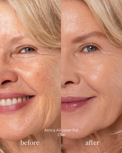 Before and after image of person who has applied Arnica All Cover Pot in the shade chai 