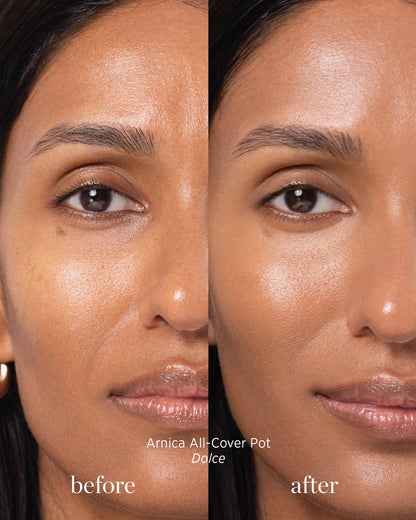 Before and after image of person who has applied Arnica All Cover Pot in the shade dolce 