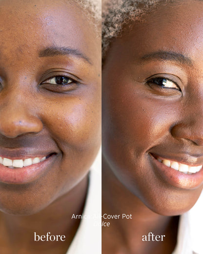 Before and after image of person who has applied Arnica All Cover Pot in the shade dolce 