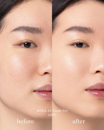 Before and after image of person who has applied Arnica All Cover Pot in the shade Latte 