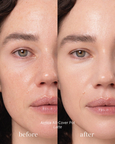 Before and after image of person who has applied Arnica All Cover Pot in the shade Latte 