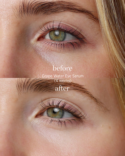 comparison after application over 4 weeks of eco-friendly eye roller and grape water serum