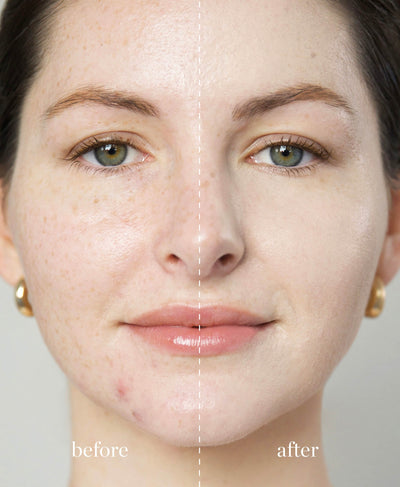 Coverage comparison of organic arnica all-cover foundation when applied to skin 